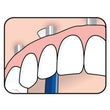 Load image into Gallery viewer, Illustration showing TePe Implant Care™ Brush cleaning implants and hard-to-reach areas.